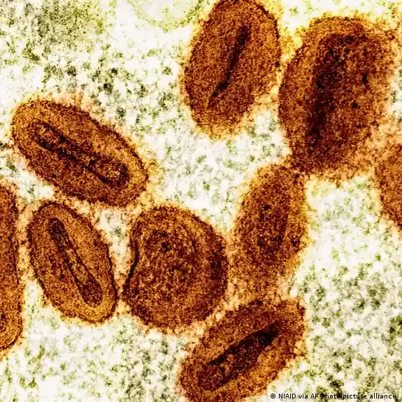 Brasil registra 88 casos confirmados de mpox em 2026; Ceará investiga quatro suspeitas