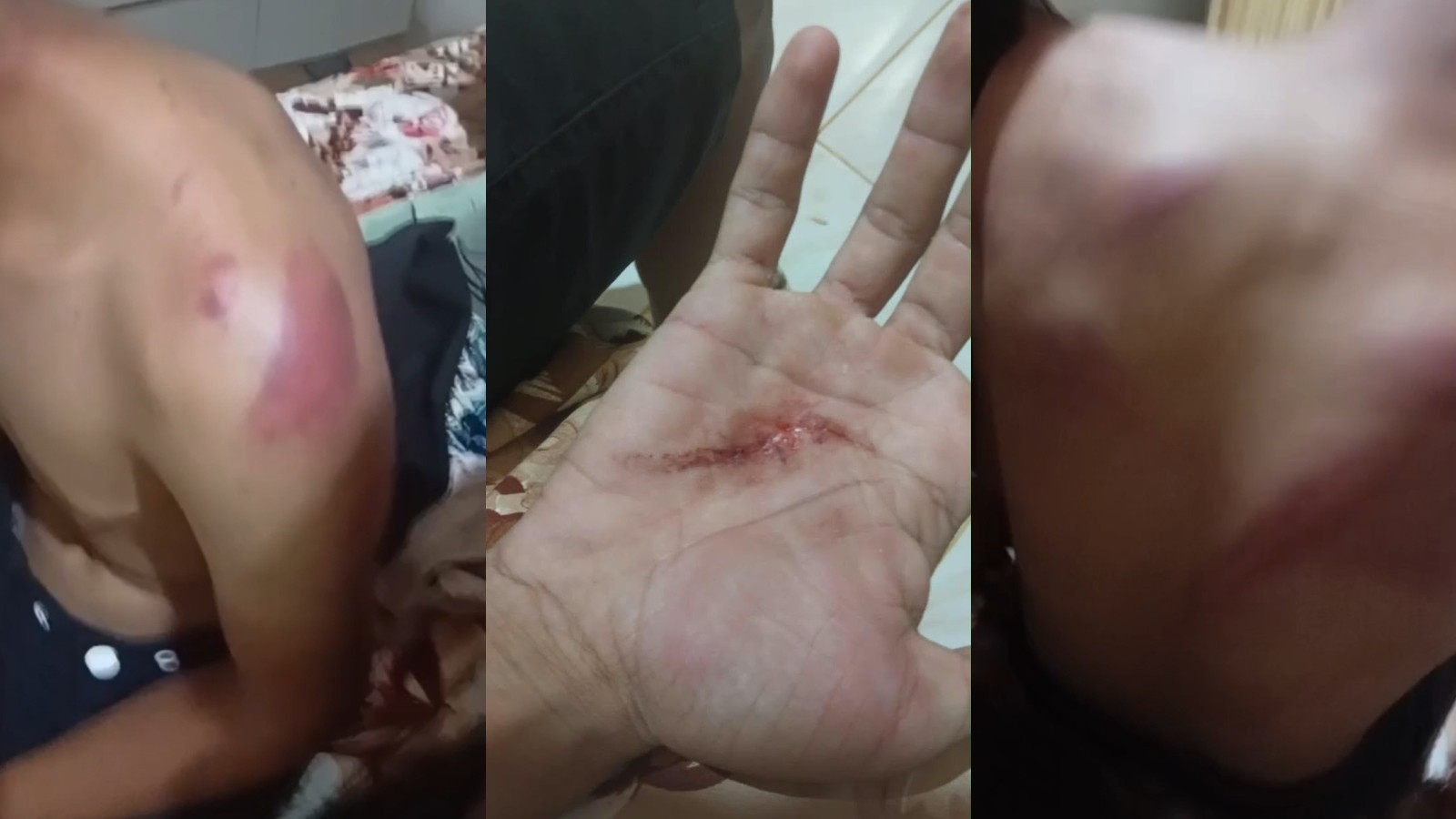 Família denuncia policiais militares por tortura contra jovem