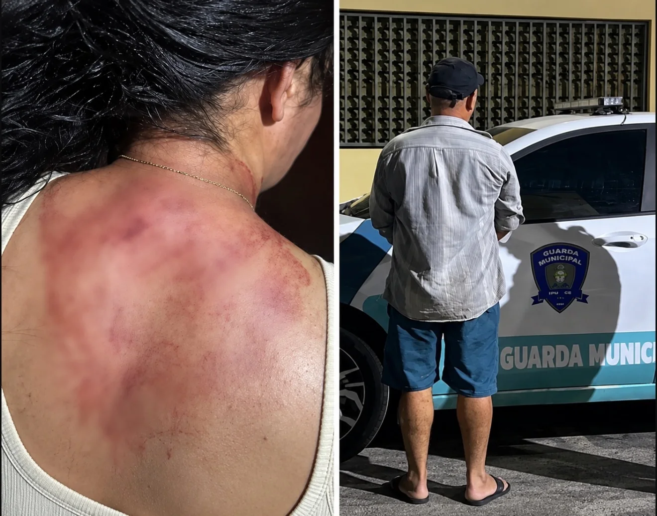“Sensação era que ele ia mat4r nós duas”, diz mulher vítima de tentativa de femi!n!cíd!o no Ceará